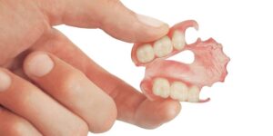 Protesi con ganci estetici
